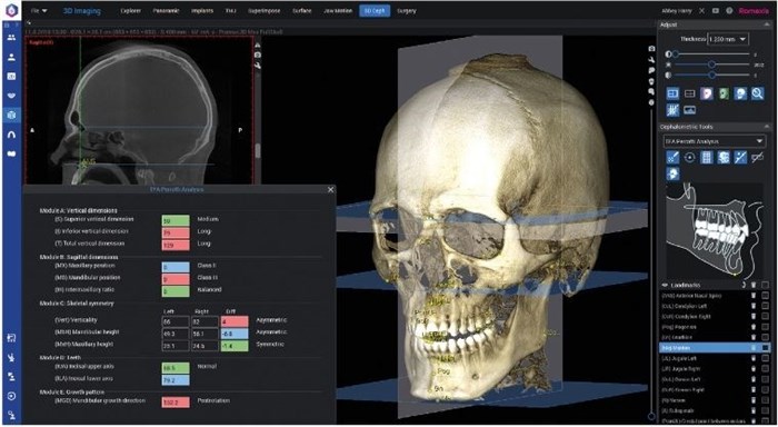 Программное обеспечение Planmeca Romexis 3D Cephalometric Analysis, лицензия на 1 пользователя FE004915 - фото 472562
