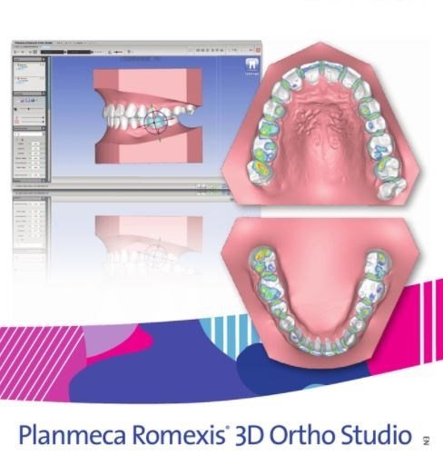 Программное обеспечение Planmeca Romexis 3D Ortho Studio Advanced FE004327 - фото 472781