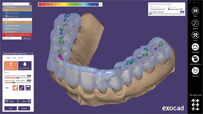 Модуль Exocad Bite splint module. Модуль шинирования зубов bitesplintmodu - фото 475580