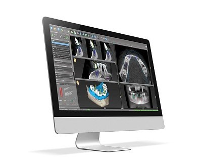 Программное обеспечение для хирургического планирования coDiagnostiX® CDX - фото 530561