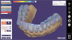 Модуль Exocad Bite splint module. Модуль шинирования зубов bitesplintmodu