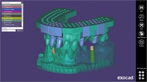 Модуль Exocad Model Creator. Модуль создания моделей ModelCreator