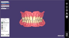 Модуль Exocad Full Denture Module. Модуль полносъемных протезов FullDentureModule