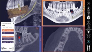 Модуль Exocad DICOM viewer. Средство просмотра DICOM файлов DICOMviewer