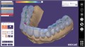 Модуль Exocad Bite splint module. Модуль шинирования зубов bitesplintmodu - фото 475580