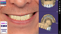 Модуль Exocad Smile Creator. Модуль планирования улыбки SmileCreator - фото 476019