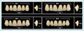 Зубы Yeti A3,5 PS жевательный низ (Tribos) 8 шт. 20304 - фото 480385