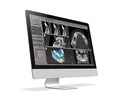 Программное обеспечение для хирургического планирования coDiagnostiX® CDX - фото 530561